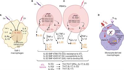 A Critical Overview of Interleukin 32 in Leishmaniases